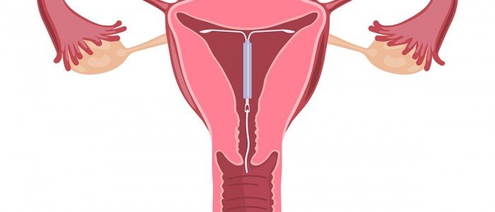 Enfermedades comunes del aparato reproductor femenino